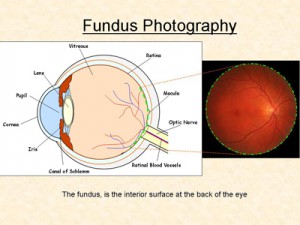 Fundus Photography Sized